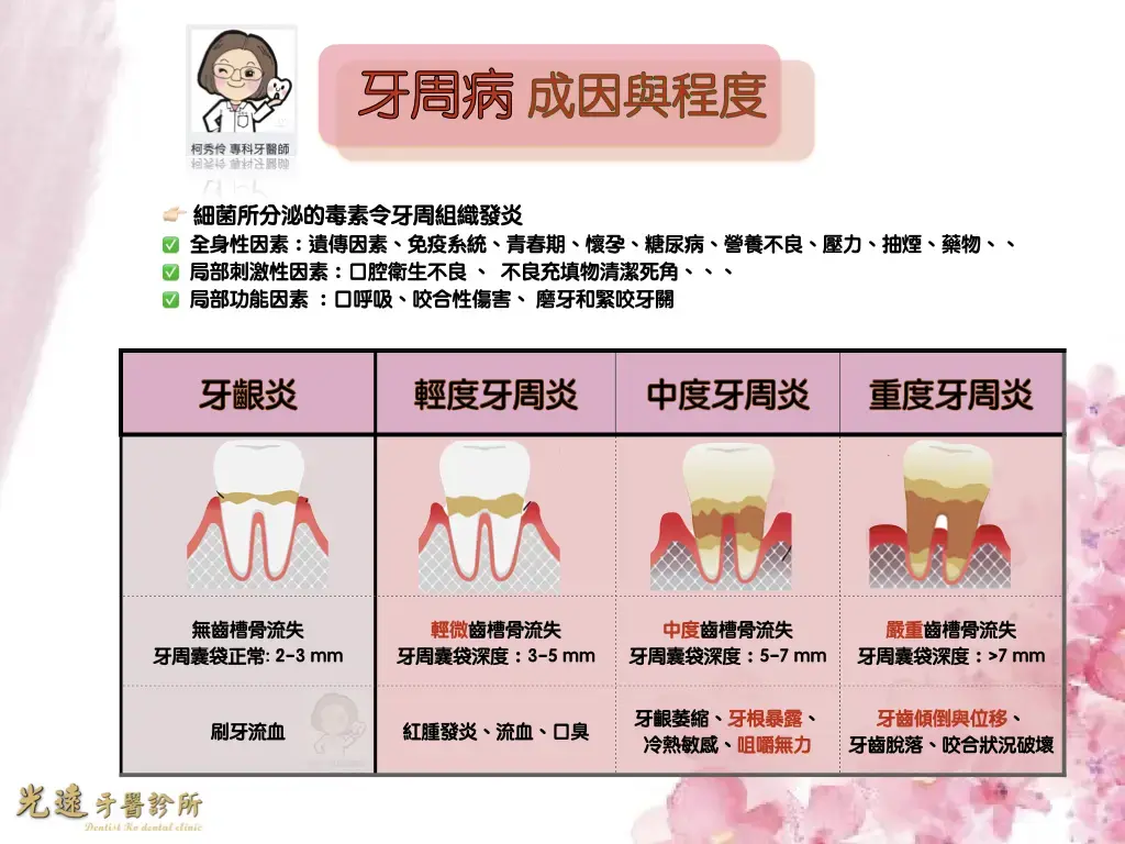 牙周治療 牙周病成因