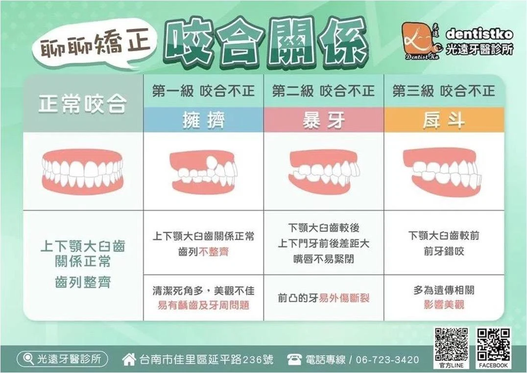 隱適美隱形矯正