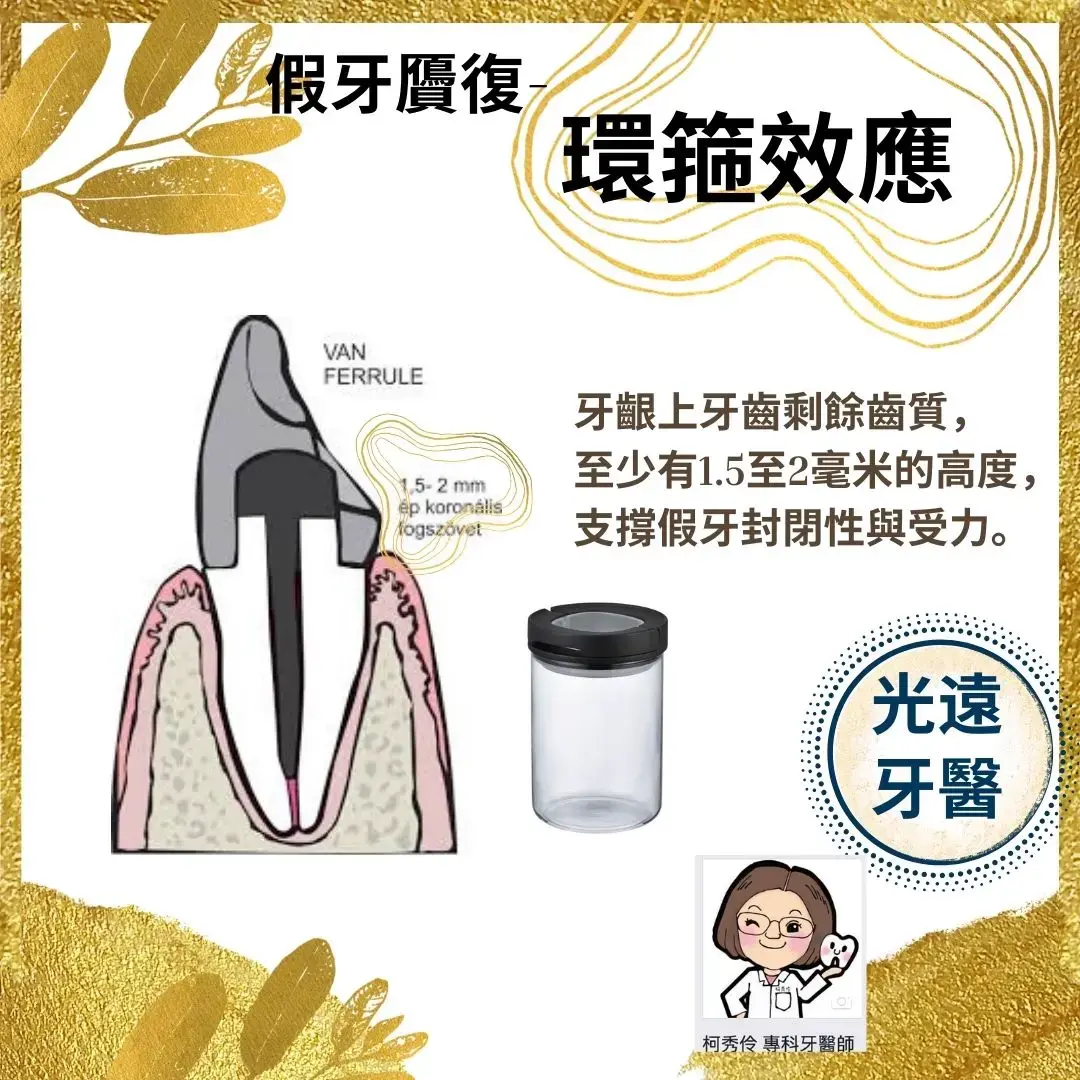 精密假牙 假牙需求
