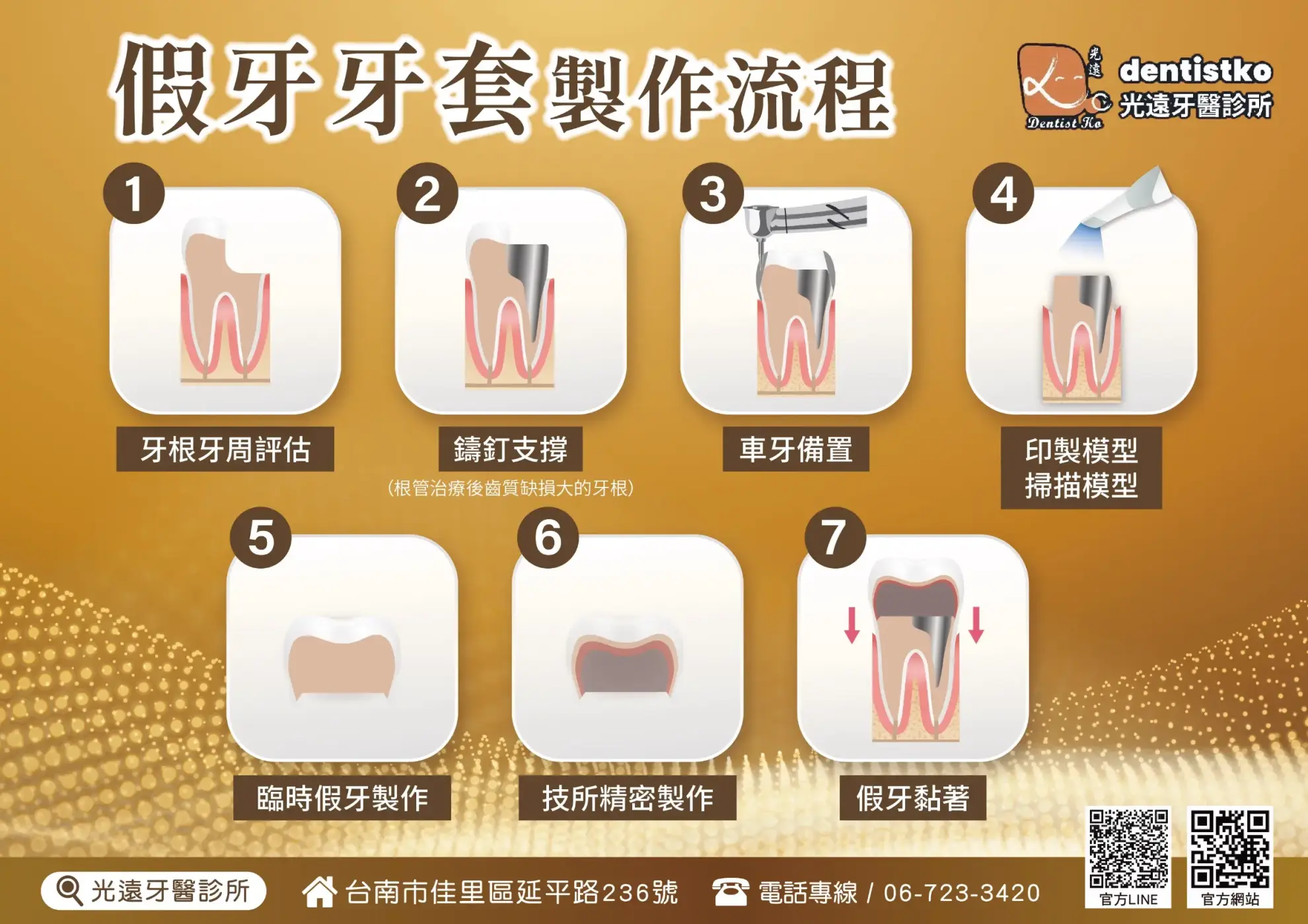 精密假牙 假牙需求