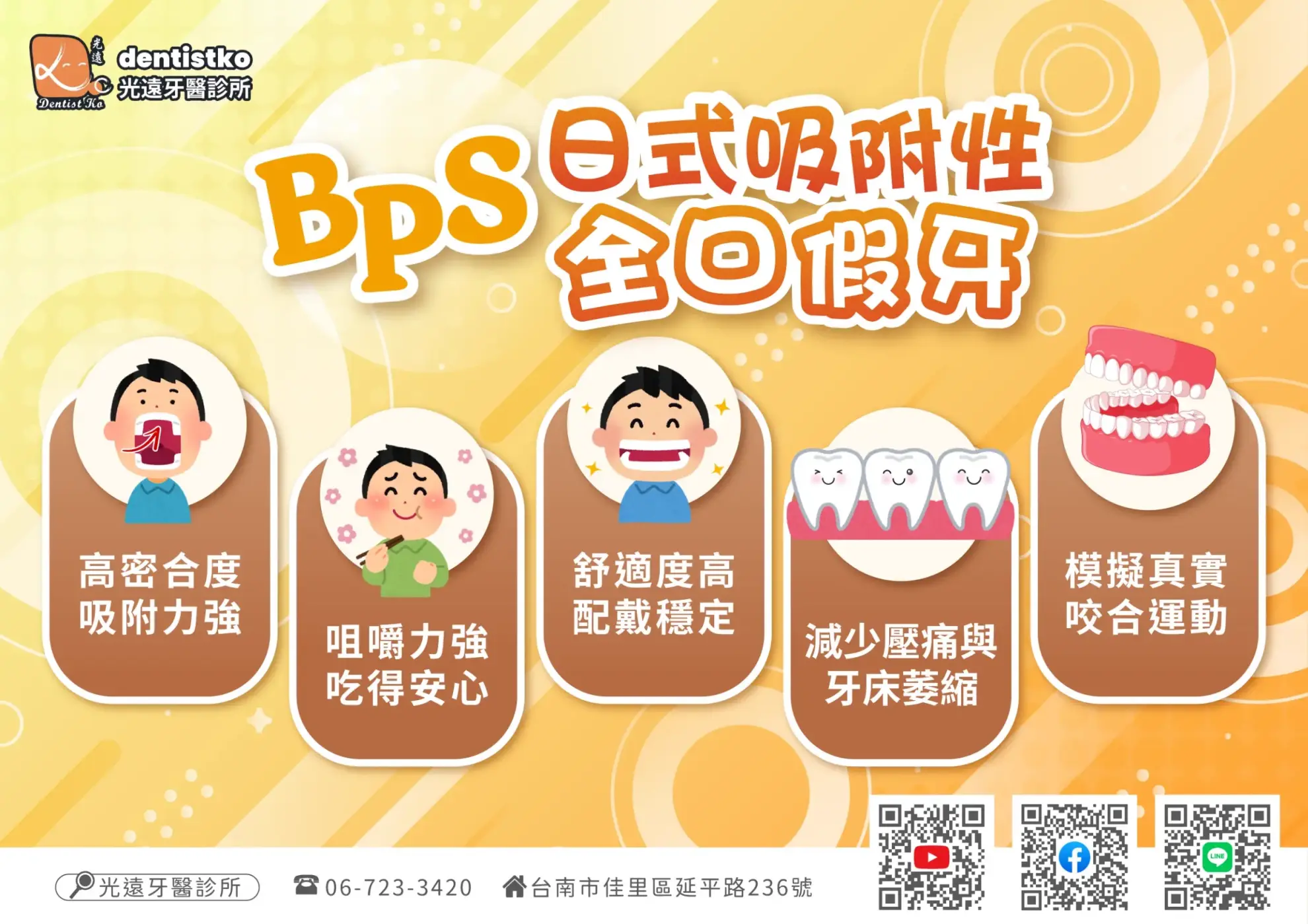 吸附式全口活動假牙