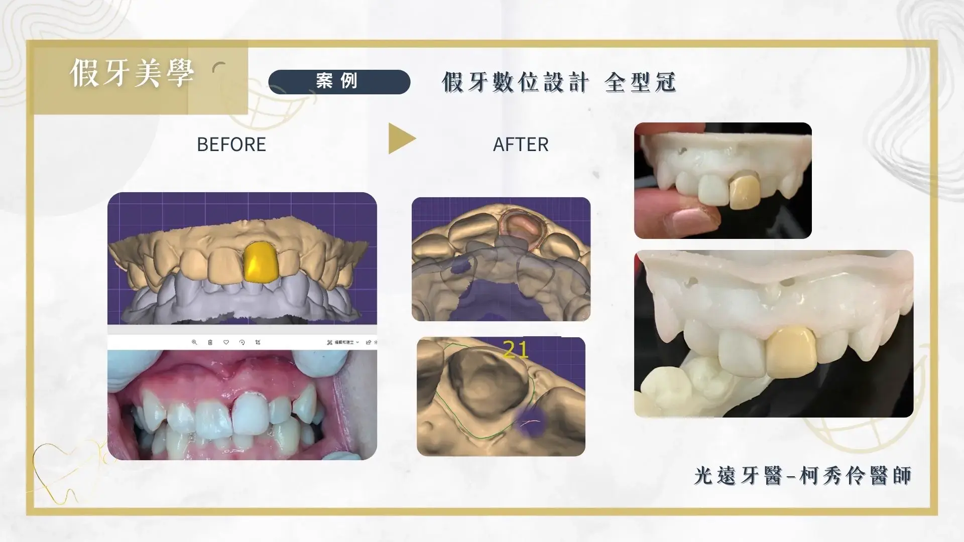 美學牙科