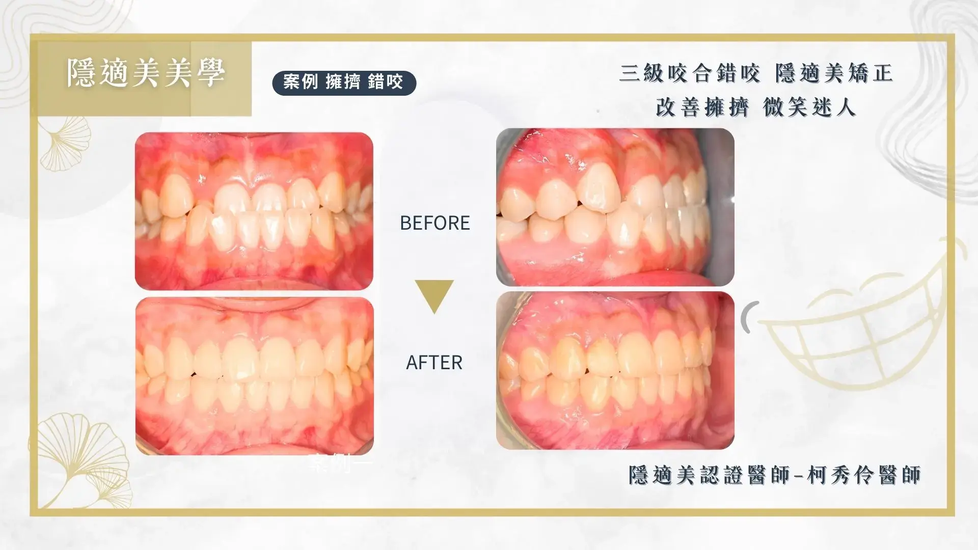 美學牙科