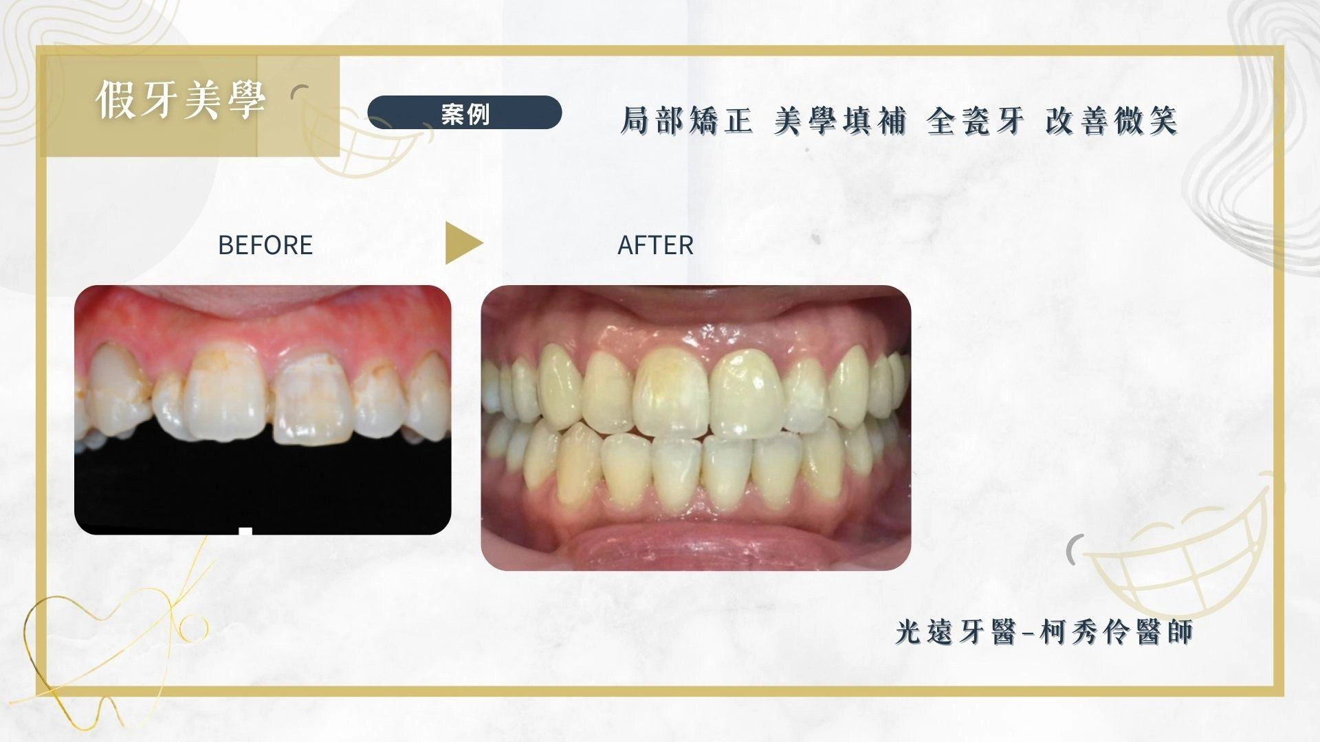 美學牙科