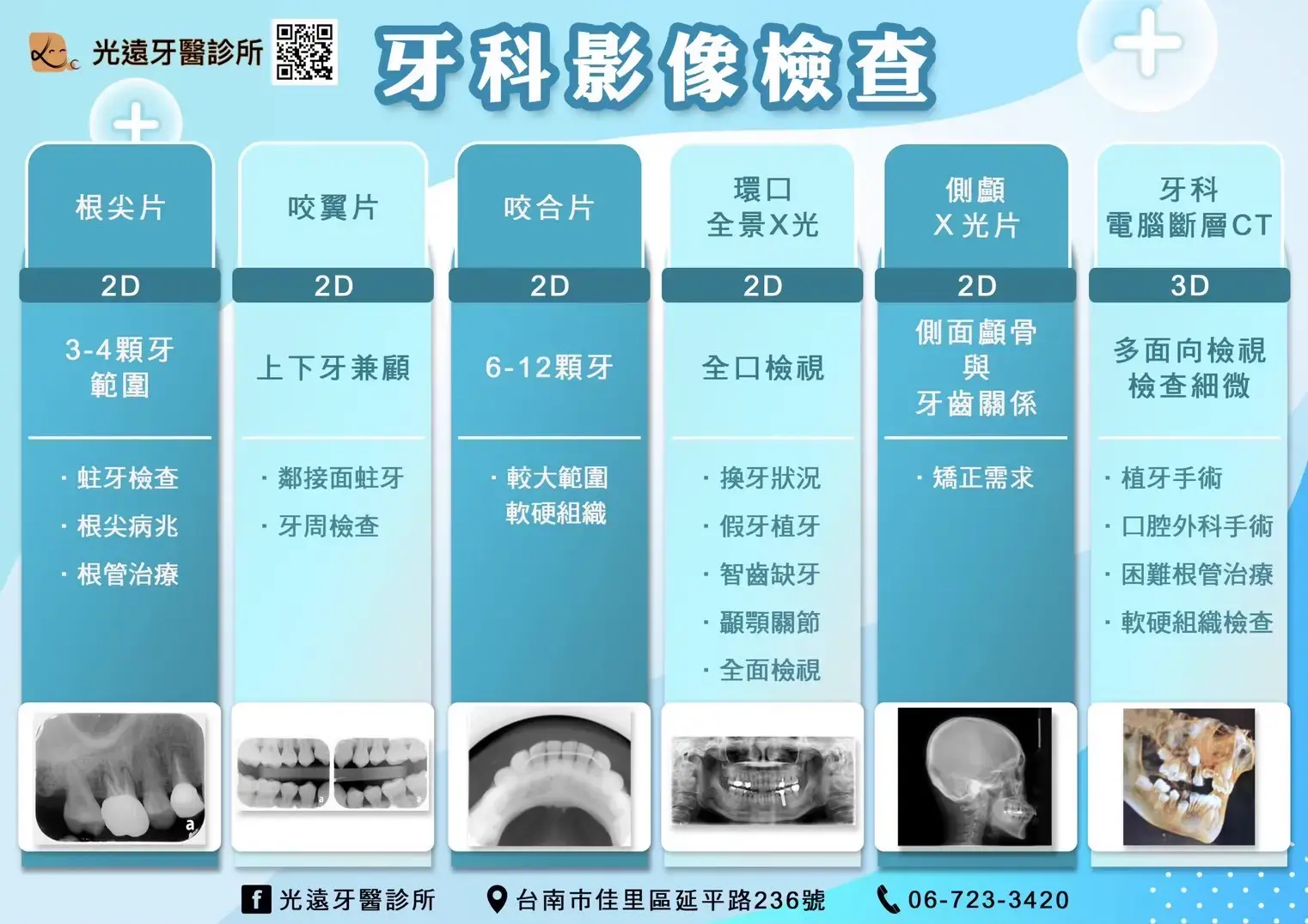 家庭牙科 牙科影像檢查