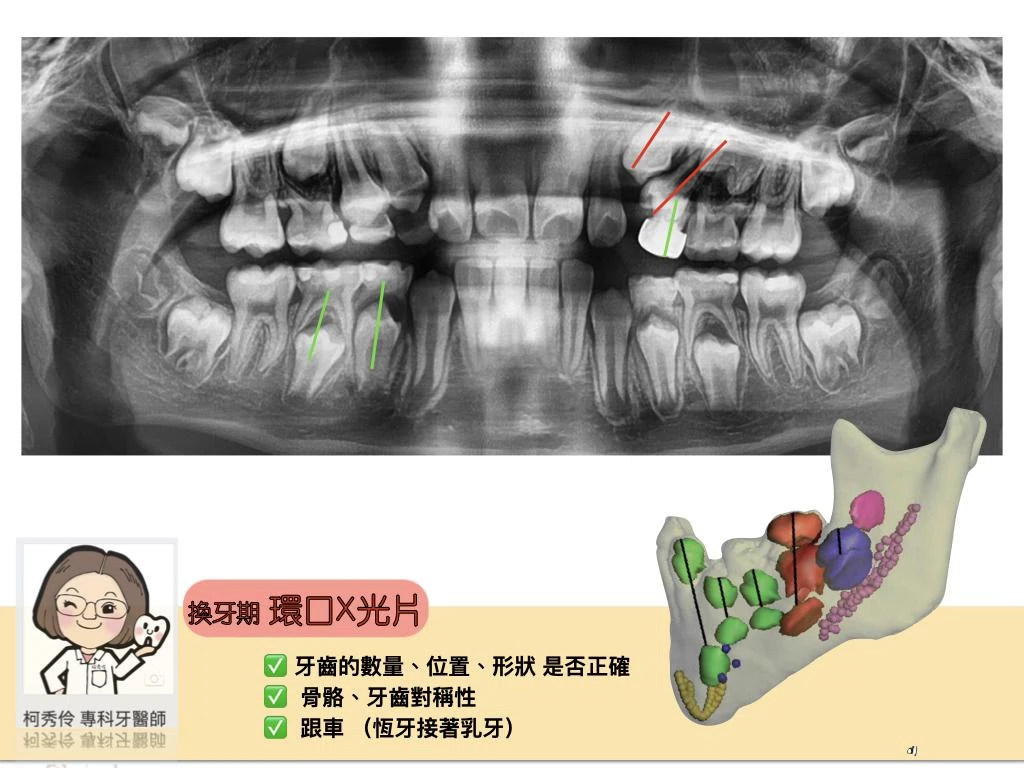 兒童傳統矯正