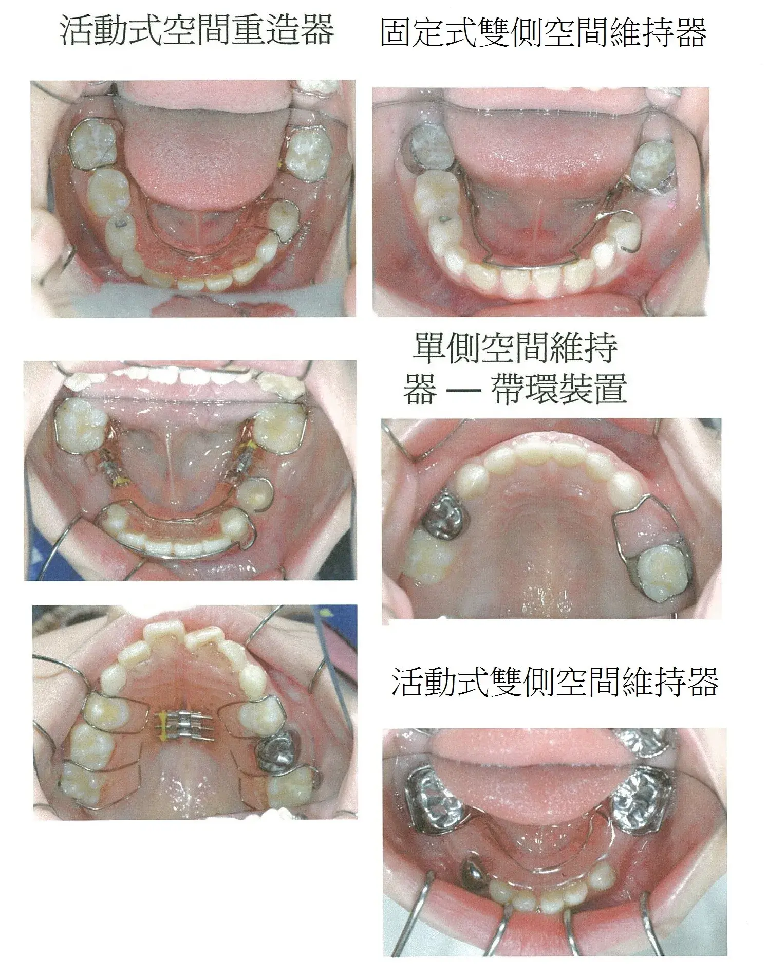 治療案例