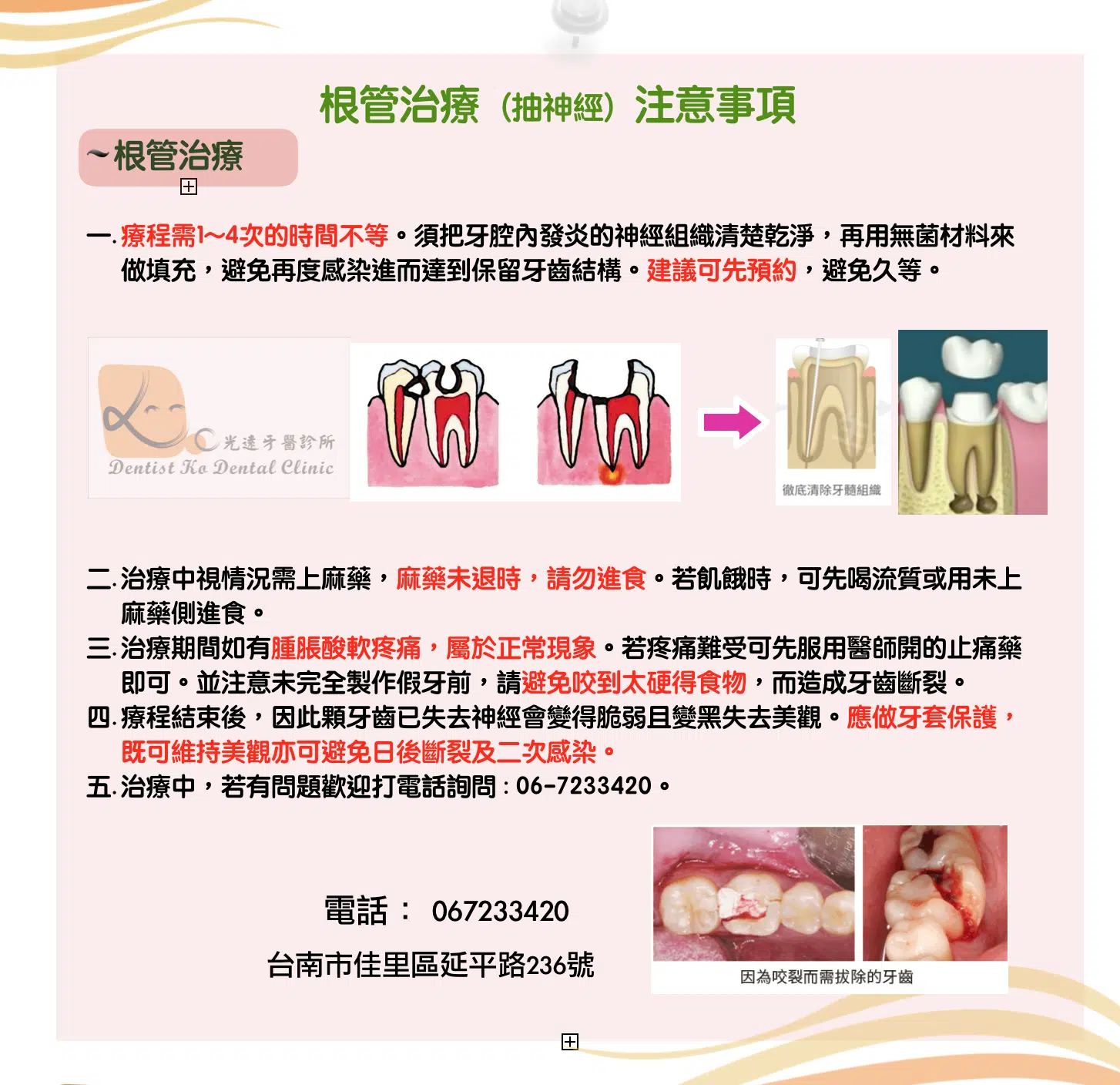 顯微根管治療