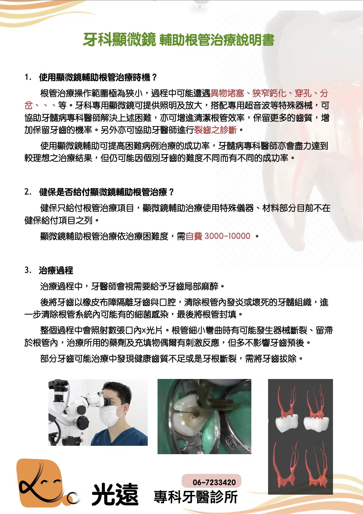 顯微根管治療