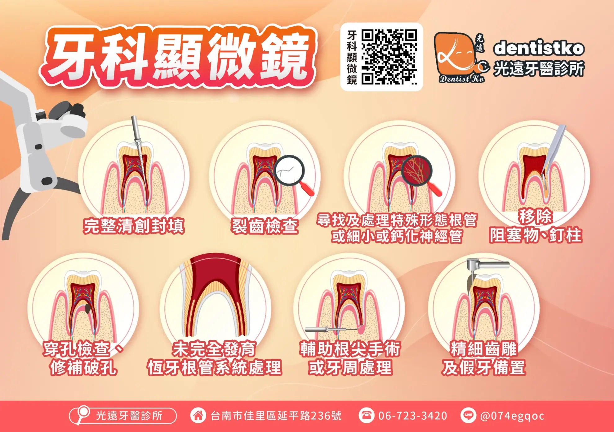 顯微根管治療