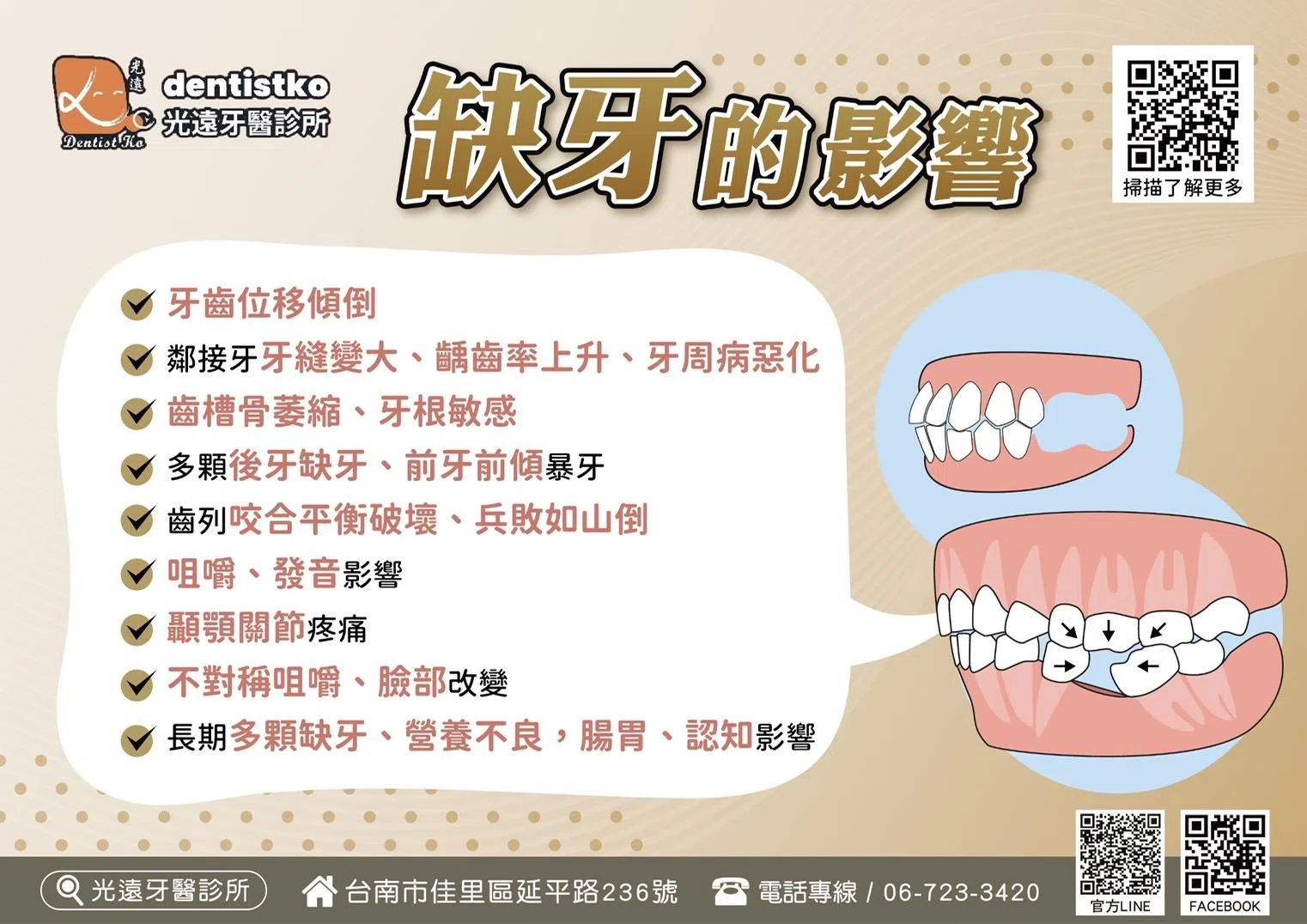全口重建 全口重建