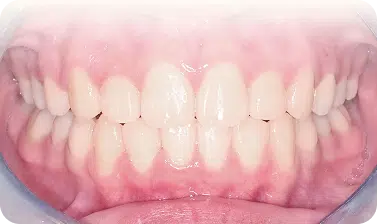 優勢
