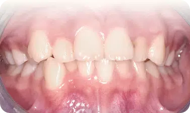 優勢
